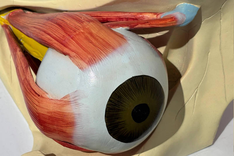 An eye patch relieves the inflamed trochlea, which can trigger cluster headaches