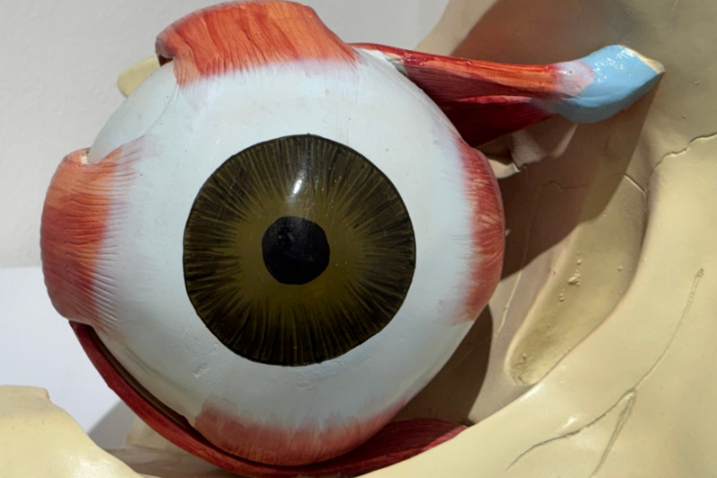 Binocular vision dysfunction leads to an inflamed trochlea: This can trigger cluster headaches