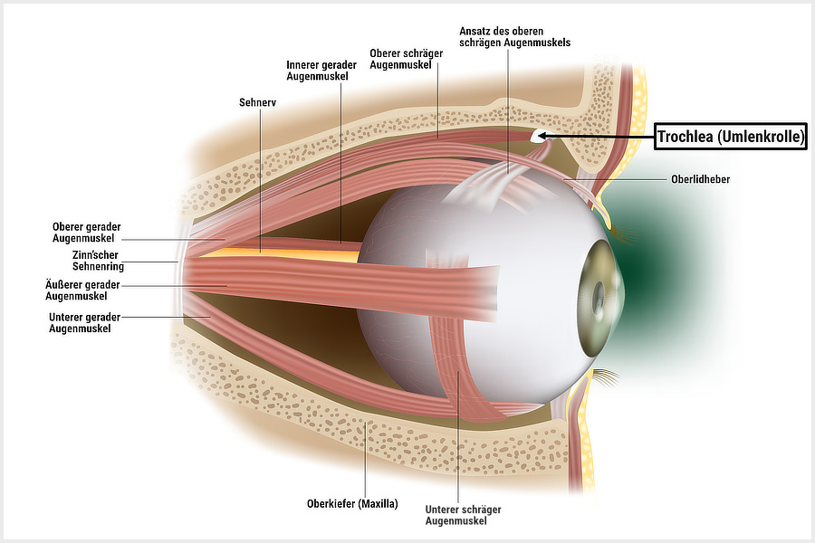 Entzündung der Trochlea als Trigger von Clusterkopfschmerzen: Eine Studie ist dringend nötig!