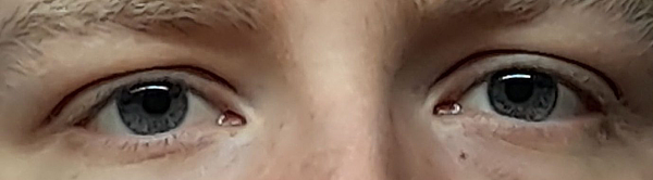 Example photo of the eye area for booking an appointment