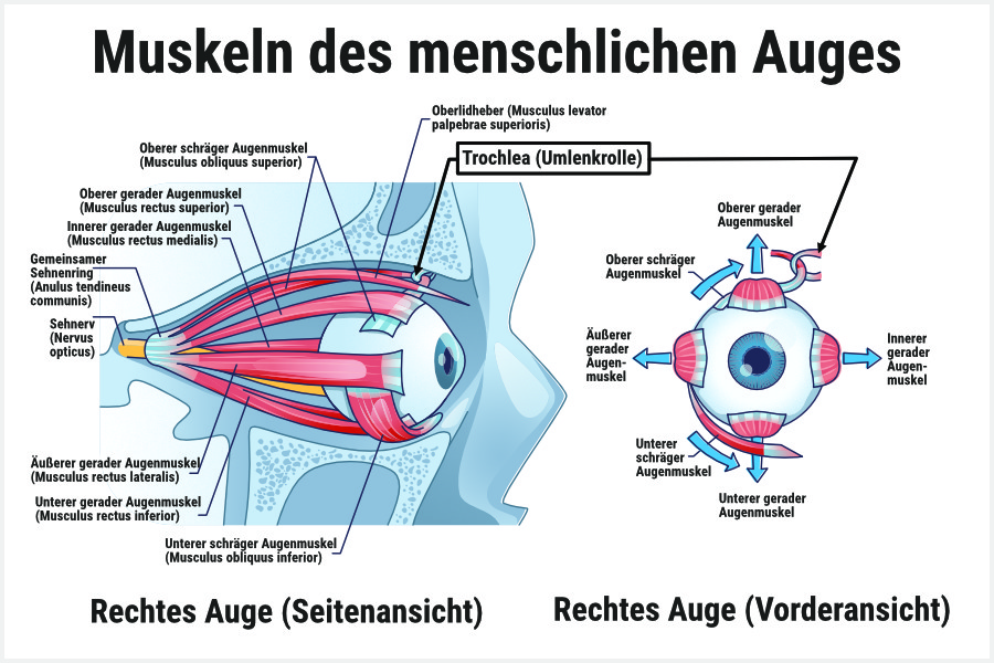 Winkelfehlsichtigkeit führt zu entzündeter Trochlea: Das kann Clusterkopfschmerzen auslösen